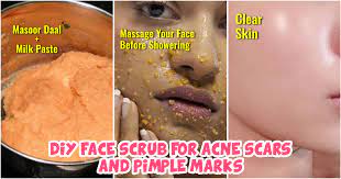 diy face scrub for acne scars and