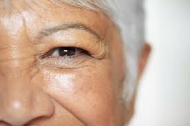 see clearly after cataract surgery