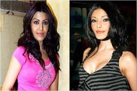 15 plastic surgery disasters of