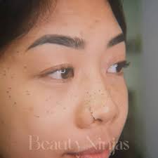 freckle tattooing permanent makeup
