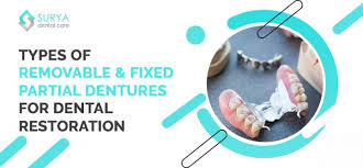 5 diffe types of partial dentures