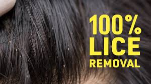 home remes for lice nits