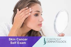 monthly skin cancer self examination