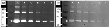 gelatin zymography gels