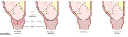 Guide To Cervix Dilation