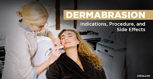 is dermabrasion safe