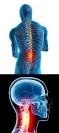 реферат травмы спинного мозга