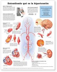 Buy Understanding Hypertension Anatomical Chart In Spanish