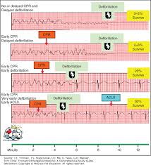 Cardiac Resuscitation Tintinallis Emergency Medicine A