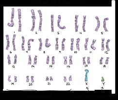 The x chromosome is significantly longer than the y chromosome and contains hundreds more this means that almost any gene on the x, even if it is recessive in the female, will. Sex Chromosomes X Linked Inheritance Article Khan Academy