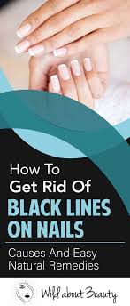 how to get rid of black lines on nails