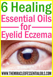 6 essential oils for eczema on eyelids