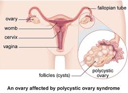 Image result for How Your Menstrual Works: The Natural Way Your Body Prevents Irregular Period