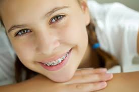 Can you straighten your teeth with your retainer? Wearing Braces How Long Do Braces Take To Work