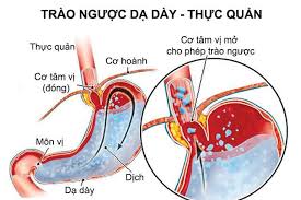 Kết quả hình ảnh cho benh tiêu hóa