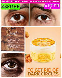 janat almond under eye dark circle