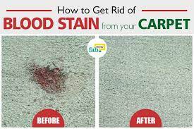 how to get blood out of carpet 4 easy