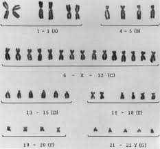 We did not find results for: Familial Syndrome Of Streak Gonads And Normal Male Karyotype In Five Phenotypic Females Nejm
