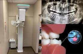 cone beam 3d imaging for enhanced