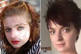 Distributeur agrée avec la sté forever living. What Happens When You Stop Drinking Alcohol Incredible Before And After Photos Show Effects Of Too Much Booze World News Mirror Online