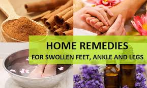 home remes for swollen feet ankle