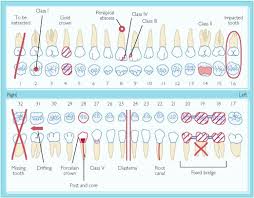 Dental Charting Practice Sheets Best Picture Of Chart