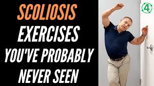 scoliosis exercises to straighten your