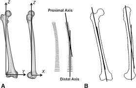 proximal and distal a