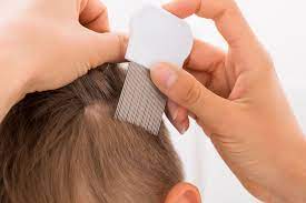 how to get rid of head lice best