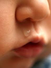 cmpa symptom baby develops swelling