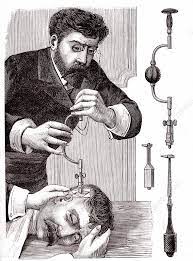 19th Century trepanning treatment, illustration - Stock Image - C051/0679 -  Science Photo Library