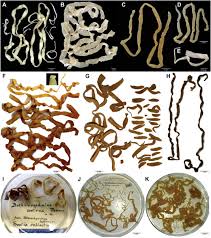 broad tapeworms diphyllobothriidae
