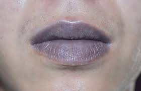 7 best ayurvedic remes for dark lips