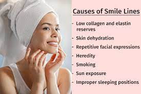 what causes smile lines how to get