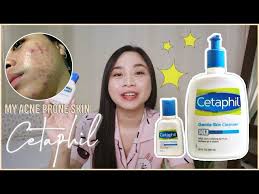 cetaphil gentle skin cleanser review