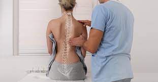 scoliosis in s what to know about