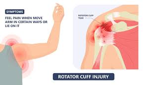 successful recovery of your rotator cuff