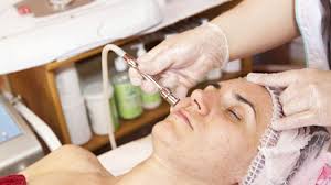The Benefits And Limits Of Microdermabrasion