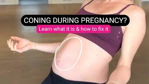 coning in pregnancy get mom strong