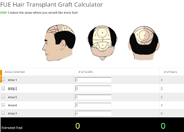 Fue Hair Transplant Graft Calculator At Andheri Help You To