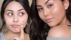 no makeup makeup look to cover acne