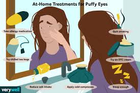 how to get rid of puffy eyes