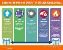 weight gain after gallbladder removal