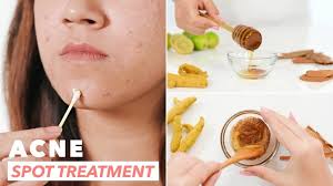 ayurvedic acne cream manufacturers in