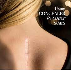 using concealer to cover a scar
