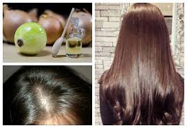 reduce hair fall and cure baldness