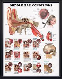 Middle Ear Conditions Chart 20x26 Middle Ear Ear Anatomy