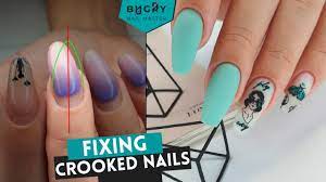 straightening crooked nails with