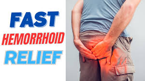 natural hemorrhoid relief treatment
