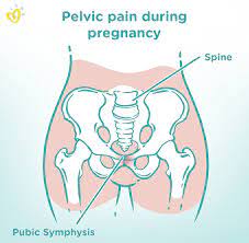 symphysis pubis dysfunction symptoms
